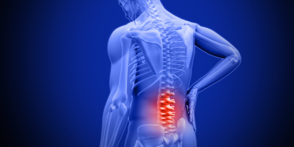 Back Pain-Somerton Physiotherapy