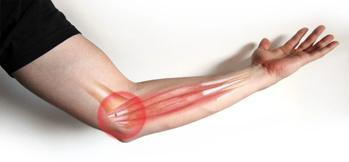 elbow