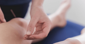 dry needling-Somerton Physiotherapy