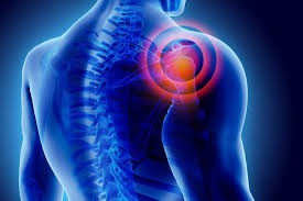 Frozen shoulder - Physiotherapy Dublin