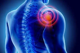 Frozen shoulder e1588076991905