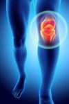 knee pain - Physiotherapy Dublin