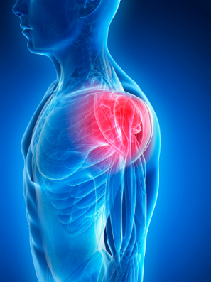 Rotator cuff shoulder injury