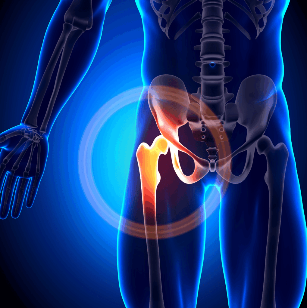 Total Hip Replacement – what is it?