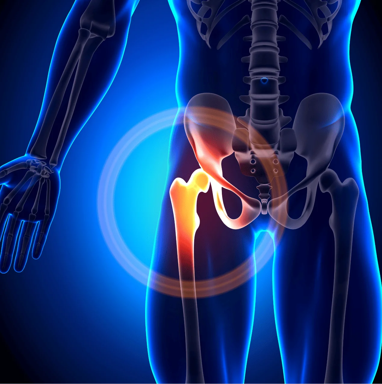 hip joint 1