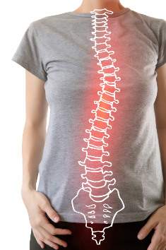 Visual representation of scoliosis showing an abnormal spinal curve on a person’s back